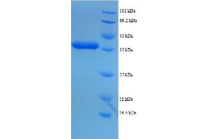 SDS-PAGE (SDS) image for Dynein, Light Chain, LC8-Type 1 (DYNLL1) (AA 1-89), (full length) protein (GST tag) (ABIN5712129) (DYNLL1 Protein (AA 1-89, full length) (GST tag))