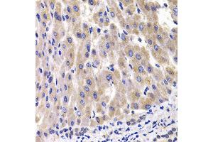 Immunohistochemistry of paraffin-embedded rat liver using RPL14 antibody at dilution of 1:100 (x400 lens). (RPL14 Antikörper)