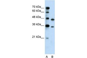 WB Suggested Anti-PRPS2 Antibody Titration:  0. (PRPS2 Antikörper  (Middle Region))