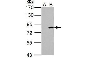 WB Image Cullin 3 antibody detects Cullin 3 protein by Western blot analysis. (Cullin 3 Antikörper)
