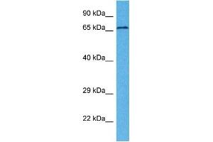 Host:  Rabbit  Target Name:  MCOLN1  Sample Tissue:  Human 786-0 Whole Cell  Antibody Dilution:  1ug/ml (MCOLN1 Antikörper  (N-Term))