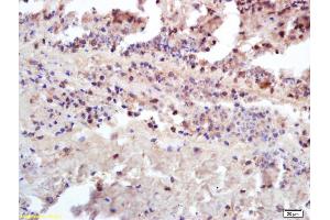 Immunohistochemistry (IHC) image for anti-Insulin Receptor beta (ISR-beta) (AA 801-900) antibody (ABIN1714205)