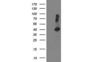 Western Blotting (WB) image for anti-TBC1 Domain Family, Member 21 (TBC1D21) antibody (ABIN1501318) (TBC1D21 Antikörper)