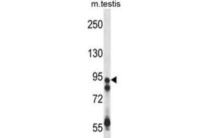 Western Blotting (WB) image for anti-Ubiquitin Specific Peptidase 20 (USP20) antibody (ABIN2998024) (USP20 Antikörper)