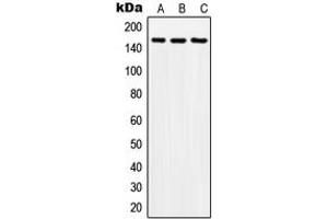 Western blot analysis of SOS2 expression in A549 (A), SP2/0 (B), H9C2 (C) whole cell lysates. (SOS2 Antikörper  (Center))
