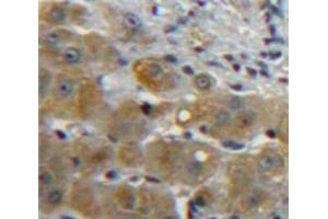 Used in DAB staining on fromalin fixed paraffin-embedded Liver tissue (CCL5 Antikörper  (AA 24-91))