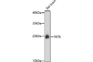 Western blot analysis of extracts of Rat brain using YKT6 Polyclonal Antibody at dilution of 1:1000. (YKT6 Antikörper)