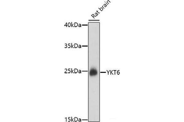 YKT6 Antikörper