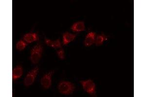 ABIN6275938 staining Hela by IF/ICC. (EMR3 Antikörper  (C-Term))