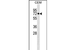 KLHL28 Antibody (C-term) (ABIN1537239 and ABIN2849863) western blot analysis in CEM cell line lysates (35 μg/lane). (KLHL28 Antikörper  (C-Term))
