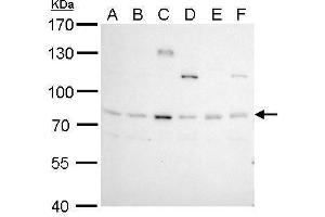 WB Image BCL6 antibody [N2C1], Internal detects BCL6 protein by Western blot analysis. (BCL6 Antikörper  (Internal Region))