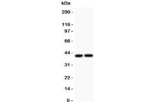Western blot testing of CXCR3 antibody and Lane 1:  COLO320;  2: SGC lysate.
