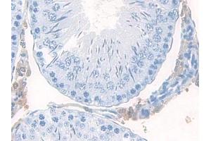 Detection of MEC in Rat Testis Tissue using Polyclonal Antibody to Mucosae Associated Epithelia Chemokine (MEC) (Mucosae Associated Epithelia Chemokine (AA 29-131) Antikörper)