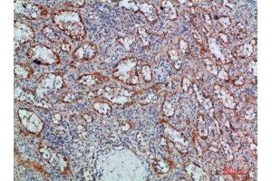 Immunohistochemical analysis of paraffin-embedded human-spleen, antibody was diluted at 1:200