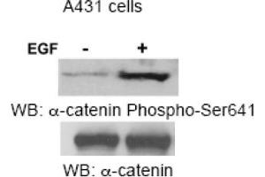 Image no. 1 for anti-Catenin (Cadherin-Associated Protein), alpha 1, 102kDa (CTNNA1) (Ser641) antibody (ABIN319361)