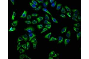 Immunofluorescence staining of Hela cells with ABIN7145154 at 1:66, counter-stained with DAPI. (CD72 Antikörper  (AA 150-208))