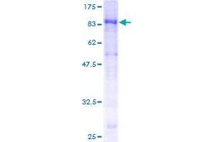 Image no. 1 for Interleukin 22 Receptor, alpha 1 (IL22RA1) (AA 19-574) protein (GST tag) (ABIN1307782)