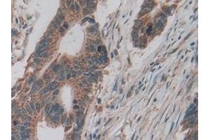 Immunohistochemistry (IHC) image for anti-Lymphotoxin beta Receptor (TNFR Superfamily, Member 3) (LTBR) (AA 66-215) antibody (ABIN7437122)