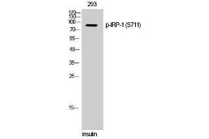 Western Blotting (WB) image for anti-Aconitase 1 (ACO1) (pSer711) antibody (ABIN3173287) (Aconitase 1 Antikörper  (pSer711))