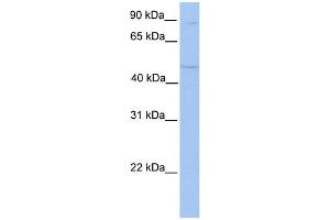 WB Suggested Anti-TMTC2 Antibody Titration:  0. (TMTC2 Antikörper  (N-Term))