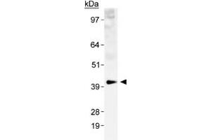 Western blot analysis of SLC2A1 in a human kidney membrane prep with SLC2A1 polyclonal antibody . (GLUT1 Antikörper  (AA 1-100))