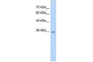 WB Suggested Anti-C6orf134 Antibody Titration:  2. (Chromosome 6 Open Reading Frame 134 (C6orf134) (N-Term) Antikörper)