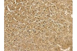 USP21 Mouse Monoclonal Antibody at 1/100 staining human normal liver tissue by IHC-P. (USP21 Antikörper)
