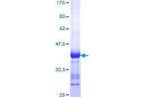 DLG1 Protein (AA 1-90) (GST tag)