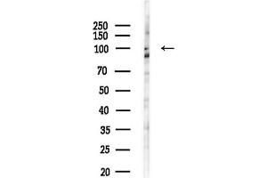 anti-rho Guanine Nucleotide Exchange Factor (GEF) 1 (ARHGEF1) (N-Term) antibody
