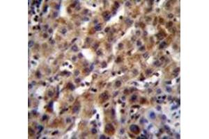 Immunohistochemistry analysis in human liver tissue (Formalin-fixed, Paraffin-embedded) using SPACA5B Antibody (N-term), followed by peroxidase conjugation of the secondary antibody and DAB staining. (SPACA5B Antikörper  (N-Term))