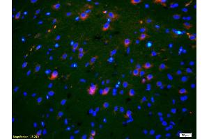 Formalin-fixed and paraffin-embedded rat brain labeled with Anti-OB/CDH11/OB-Cadherin Polyclonal Antibody, Unconjugated (ABIN1387539) 1:200, overnight at 4°C, The secondary antibody was Goat Anti-Rabbit IgG, Cy3 conjugated used at 1:200 dilution for 40 minutes at 37°C. (OB Cadherin Antikörper  (AA 310-360))