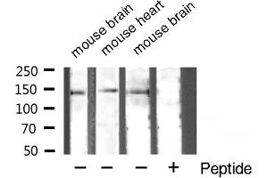 Western blot analysis of TSC1 expression in various cell lysate