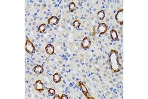 Immunohistochemistry of paraffin-embedded rat kidney using GABARAP antibody (ABIN6129966, ABIN6140874, ABIN6140877 and ABIN6221250) at dilution of 1:100 (40x lens). (GABARAP Antikörper  (AA 1-117))