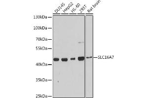 Western blot analysis of extracts of various cell lines, using SLC16 antibody (ABIN3017189, ABIN3017190, ABIN3017191 and ABIN6219987) at 1:3000 dilution. (SLC16A7 Antikörper  (C-Term))