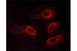 ABIN6267565 staining HeLa cells treated with PMA 125ng/ml 30' by ICC/IF. (14-3-3 zeta Antikörper  (pSer58))