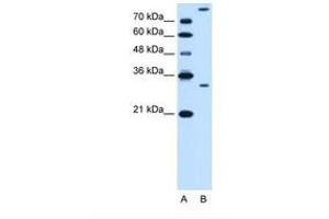 Image no. 1 for anti-Granzyme K (Granzyme 3, Tryptase II) (GZMK) (AA 78-127) antibody (ABIN6738148) (GZMK Antikörper  (AA 78-127))