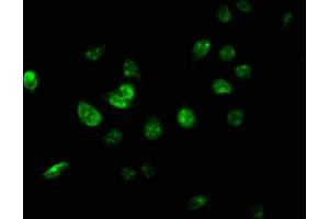 Immunofluorescence staining of A549 cells with ABIN7174336 at 1:267, counter-stained with DAPI. (USP46 Antikörper  (AA 66-166))