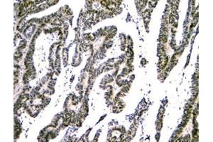 IHC analysis of NFIA using anti-NFIA antibody (ABIN6719349). (NFIA Antikörper  (Middle Region))