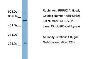 Western Blotting (WB) image for anti-Protein Phosphatase 5, Catalytic Subunit (PPP5C) (Middle Region) antibody (ABIN2774158) (PP5 Antikörper  (Middle Region))