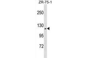 Western Blotting (WB) image for anti-Zinc Fingers and Homeoboxes 2 (ZHX2) antibody (ABIN3000459) (ZHX2 Antikörper)