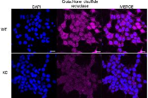 Immunocytochemical staining of HeLa cells using Glutathione-disulfide reductase antibody (ABIN7798754), 1:1,000), Top panel: wild-type (WT), Bottom panal: Glutathione-disulfide reductase shRNA knockdown (KD).