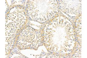 ABIN6260422 and ABIN6268873 at 1/100 staining Rat testis tissue by IHC-P. (DREAM Antikörper  (Internal Region))
