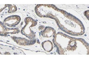 ABIN6273587 at 1/100 staining Human prostate tissue by IHC-P. (TCHP Antikörper  (C-Term))