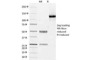 SDS-PAGE Analysis of Purified, BSA-Free Cytokeratin 10/13 Antibody (clone DE-K13). (Keratin 10/13 Antikörper)