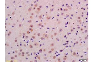 Formalin-fixed and paraffin embedded mouse brain labeled with Anti-PPT1 Polyclonal Antibody, Unconjugated (ABIN718946) at 1:200 followed by conjugation to the secondary antibody and DAB staining