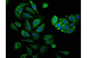 Immunofluorescence (IF) image for anti-Proteasome (Prosome, Macropain) 26S Subunit, ATPase, 3 (PSMC3) (AA 1-300), (Regulatory Subunit 6A) antibody (ABIN7142230)