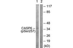 Western blot analysis of extracts from 293 cells treated with Etoposide 25uM 60', using Caspase 6 (Phospho-Ser257) Antibody. (Caspase 6 Antikörper  (pSer257))