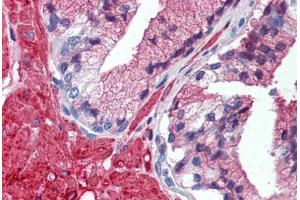 Human Prostate (formalin-fixed, paraffin-embedded) stained with TRAF2 antibody ABIN297934 at 5 ug/ml followed by biotinylated anti-mouse IgG secondary antibody ABIN481714, alkaline phosphatase-streptavidin and chromogen. (TRAF2 Antikörper  (AA 205-222))