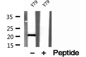 Western Blotting (WB) image for anti-TAF12 RNA Polymerase II, TATA Box Binding Protein (TBP)-Associated Factor, 20kDa (TAF12) (N-Term) antibody (ABIN6265436)