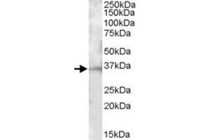 BTLA polyclonal antibody  (1 ug/mL) staining of mouse spleen lysate (35 ug protein in RIPA buffer).